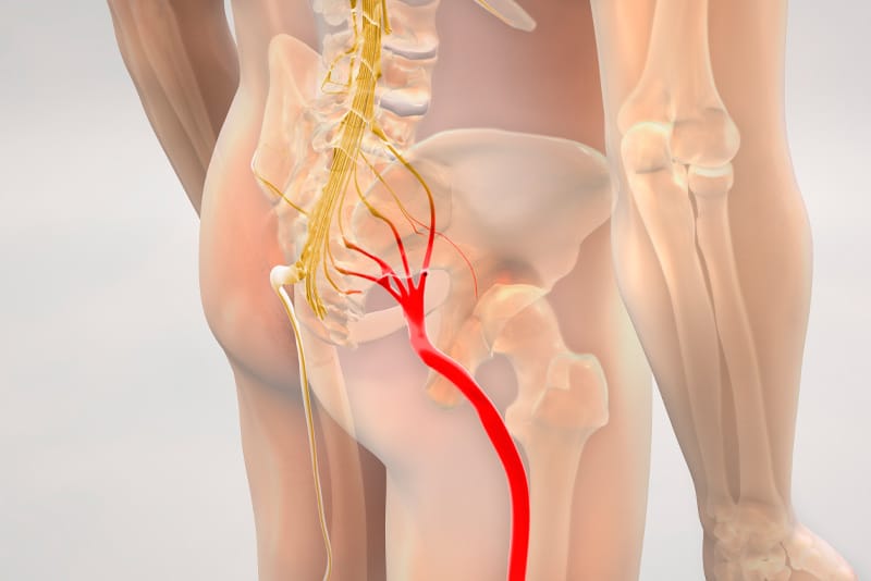 Diagram of the sciatic nerve